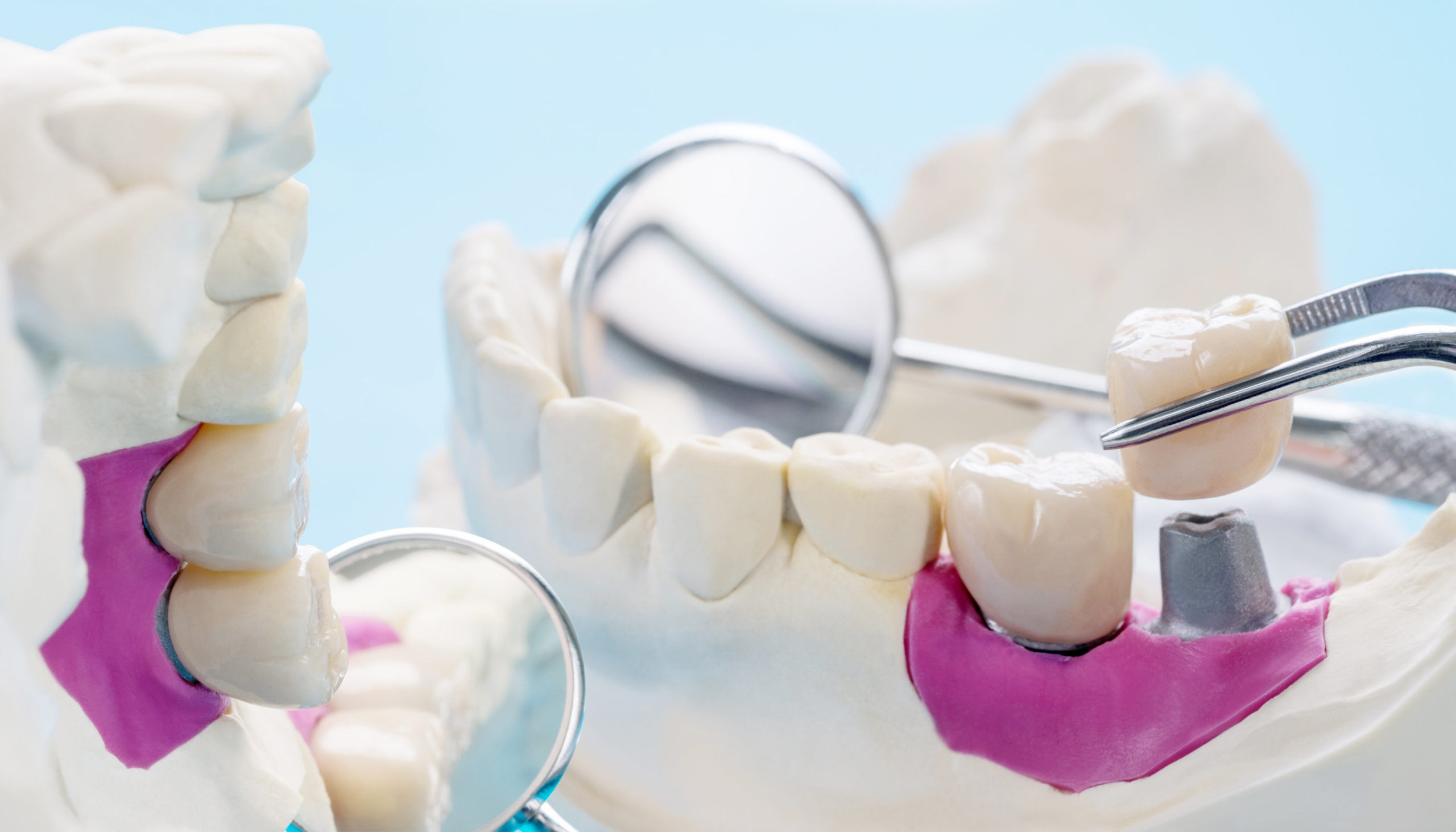 Read more about the article What Is A Prosthodontist?